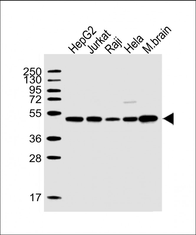 WB - CTBP1 Antibody (C-term) AW5095-U100